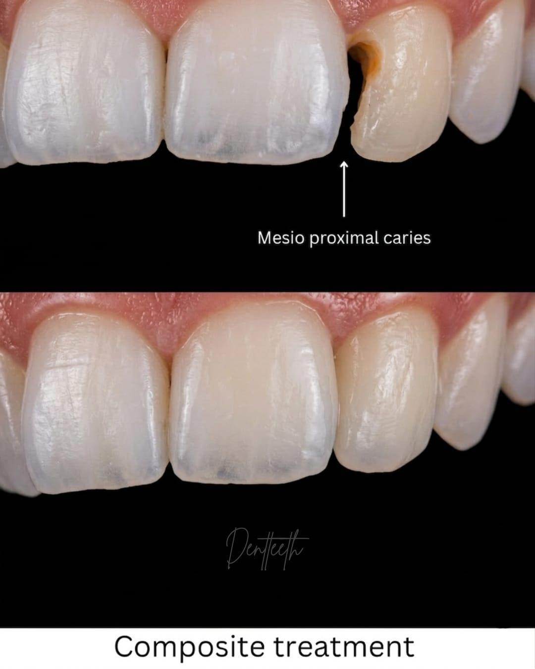 Signature Dental Restoration Case